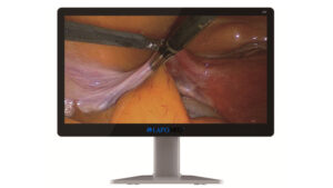 2687059046_endoskopichnij-monitor-lapomed-1-1.jpg