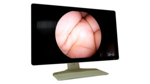 3033760596_endoskopichnij-monitor-lapomed-2.jpg
