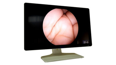 3033760596_endoskopichnij-monitor-lapomed-2.jpg