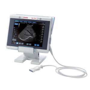 1360369501_ultrazvukovoj-apparat-mylab.jpg