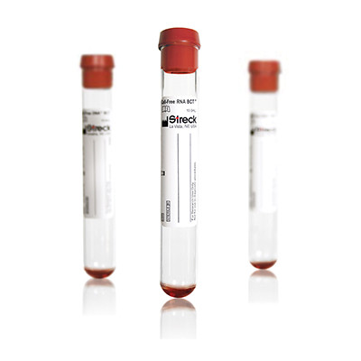 1392249249_probirki-cell-free-rna.jpg