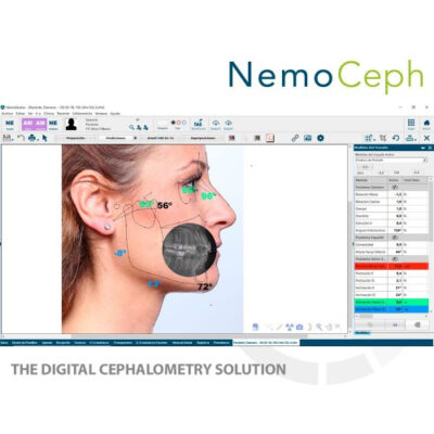 2428779651_nemoceph.jpg