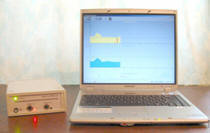 2522745035_aparat-trima-reamed-a.jpg