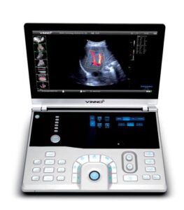 2706959343_sistema-ultrazvukovoj-diagnostiki.jpg
