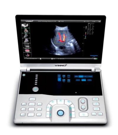 2706959343_sistema-ultrazvukovoj-diagnostiki.jpg